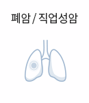 폐암/직업성암